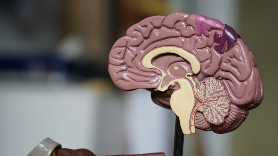 Stroke & Neuro Rehab